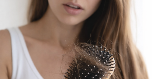 Iron Deficiency Hair Loss: Causes, Diagnosis, and How to Regrow Hair (2026 Guide)