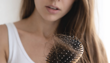 Iron Deficiency Hair Loss: Causes, Diagnosis, and How to Regrow Hair (2026 Guide)